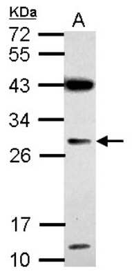 Western Blot: IMP4 Antibody [NBP2-16962]