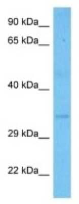 Western Blot: IMP4 Antibody [NBP3-10045]