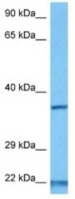 Western Blot: IMP4 Antibody [NBP3-10099]