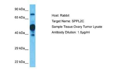 Western Blot: IMP5 Antibody [NBP2-86676]