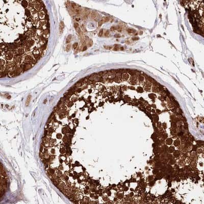 Immunohistochemistry-Paraffin: IMPA1 Antibody [NBP1-83107]