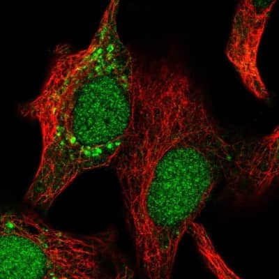 Immunocytochemistry/ Immunofluorescence: IMPA2 Antibody [NBP1-86352]