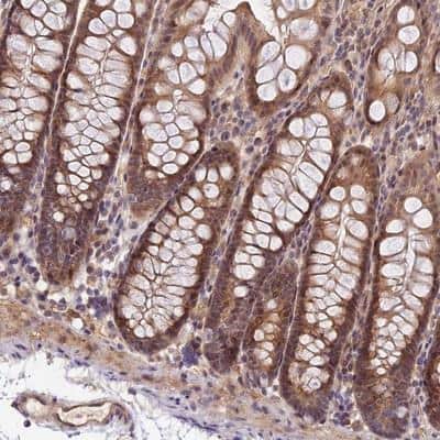 Immunohistochemistry-Paraffin: IMPACT Antibody [NBP1-86234]