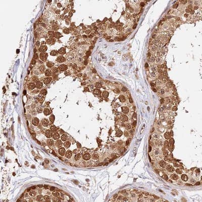 Immunohistochemistry-Paraffin: IMPACT Antibody [NBP1-86221]