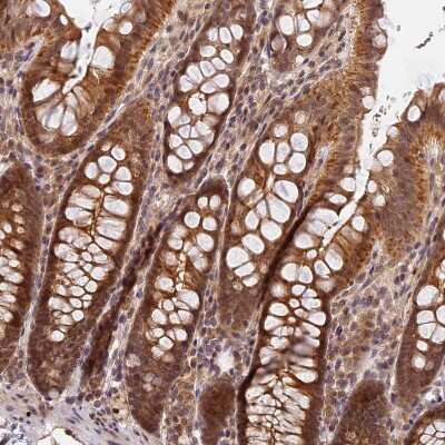 Immunohistochemistry-Paraffin: IMPACT Antibody [NBP1-86221]