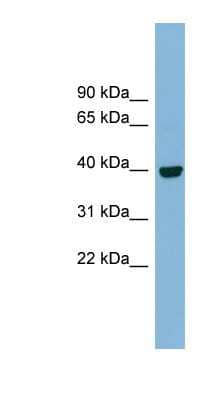 Western Blot: Inositol Monophosphatase 3/IMPAD1 Antibody [NBP1-59473]