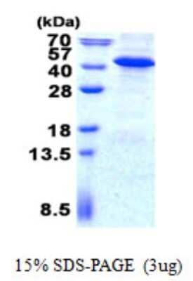 SDS-PAGE: Recombinant Human Inositol Monophosphatase 3/IMPAD1 His Protein [NBP2-23140]