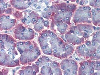 Immunohistochemistry-Paraffin: IMPDH1 Antibody [NBP1-52933]