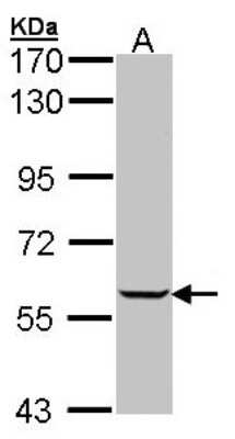 Western Blot: IMPDH1 Antibody [NBP1-32854]