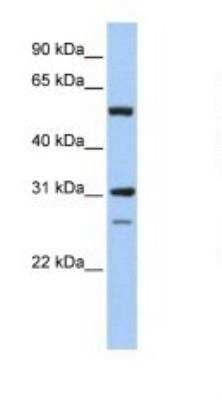 Western Blot: IMPDH1 Antibody [NBP1-52933]