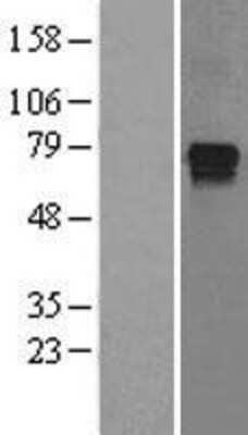 Western Blot: IMPDH1 Overexpression Lysate [NBL1-11985]