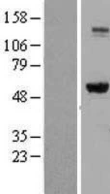 Western Blot: IMP Dehydrogenase 2/IMPDH2 Overexpression Lysate [NBL1-11987]