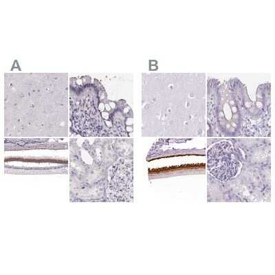 Immunohistochemistry-Paraffin: IMPG1 Antibody [NBP2-55575]