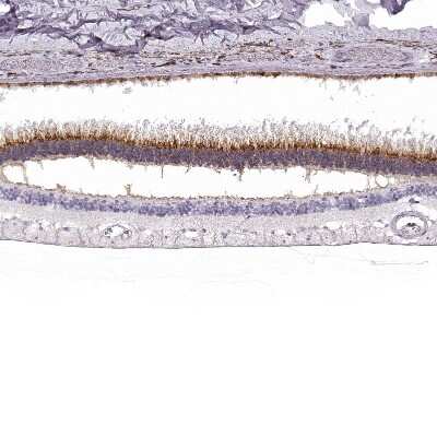 Immunohistochemistry-Paraffin: IMPG1 Antibody [NBP2-55575]