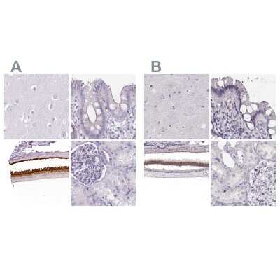 Immunohistochemistry-Paraffin: IMPG1 Antibody [NBP2-57460]