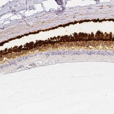 Immunohistochemistry-Paraffin: IMPG1 Antibody [NBP2-57461]