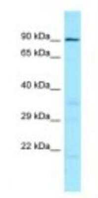 Western Blot: IMPG1 Antibody [NBP1-98597]