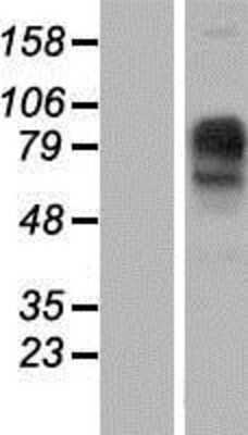 Western Blot: IMPG1 Overexpression Lysate [NBP2-08190]