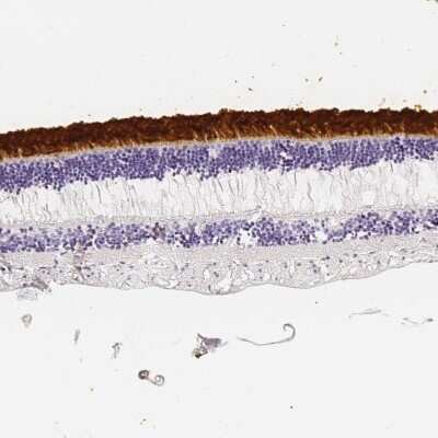 Immunohistochemistry-Paraffin: IMPG2 Antibody [NBP2-54954]