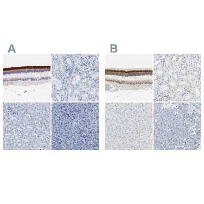 Immunohistochemistry-Paraffin: IMPG2 Antibody [NBP2-54954]