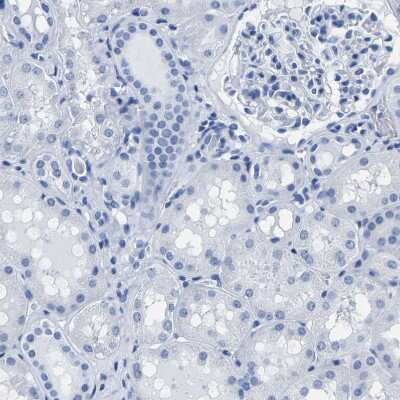 Immunohistochemistry-Paraffin: IMPG2 Antibody [NBP2-54954]