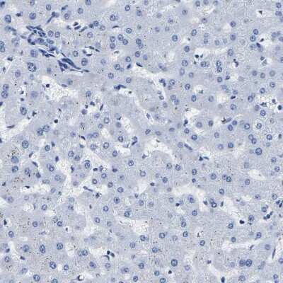 Immunohistochemistry-Paraffin: IMPG2 Antibody [NBP2-54954]