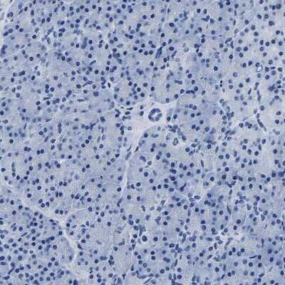 Immunohistochemistry-Paraffin: IMPG2 Antibody [NBP2-54954]