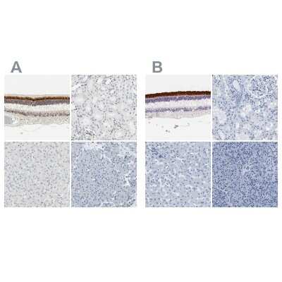 Immunohistochemistry-Paraffin: IMPG2 Antibody [NBP2-58919]