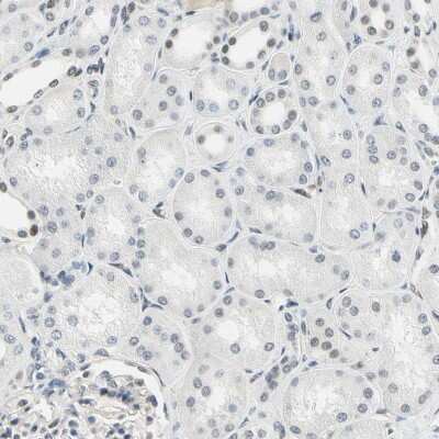 Immunohistochemistry-Paraffin: IMPG2 Antibody [NBP2-58919]