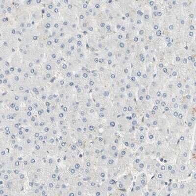 Immunohistochemistry-Paraffin: IMPG2 Antibody [NBP2-58919]