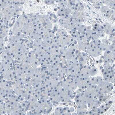 Immunohistochemistry-Paraffin: IMPG2 Antibody [NBP2-58919]