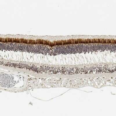 Immunohistochemistry-Paraffin: IMPG2 Antibody [NBP2-58919]