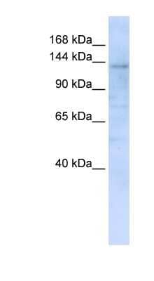 Western Blot: IMPG2 Antibody [NBP1-62656]