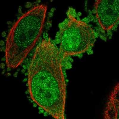 Immunocytochemistry/ Immunofluorescence: IMUP Antibody [NBP2-56024]