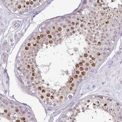 Immunohistochemistry-Paraffin: IMUP Antibody [NBP2-14392]