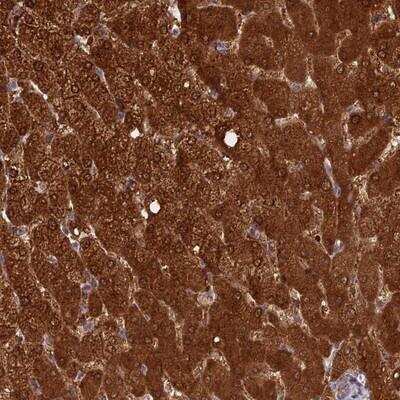 Immunohistochemistry-Paraffin: INCA1 Antibody [NBP1-90960]