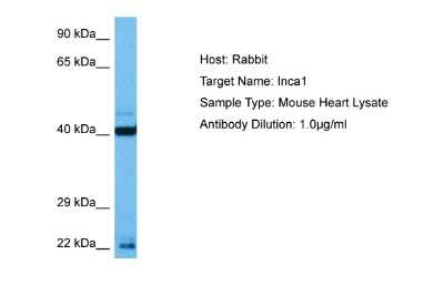 Western Blot: INCA1 Antibody [NBP2-85091]