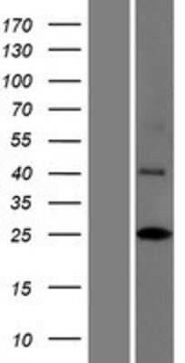 Western Blot: INCA1 Overexpression Lysate [NBP2-04460]