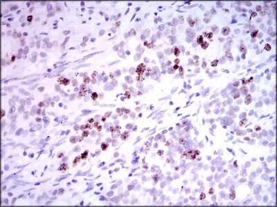 Immunohistochemistry-Paraffin: INCENP Antibody (3D2) - BSA Free [NBP2-37471]