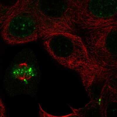 Immunocytochemistry/ Immunofluorescence: INCENP Antibody [NBP2-57266]