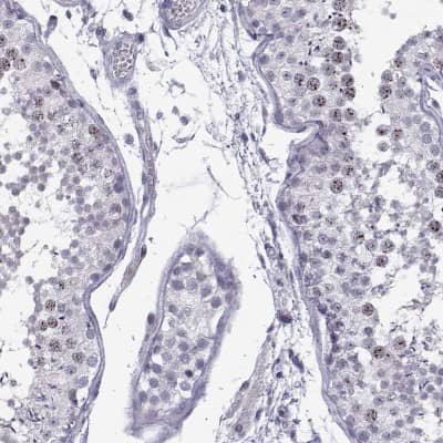 Immunohistochemistry-Paraffin: INCENP Antibody [NBP2-62620]