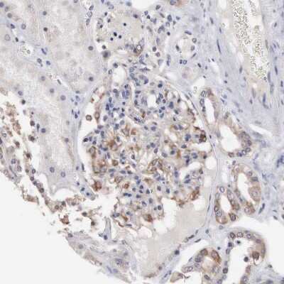 Immunohistochemistry-Paraffin: INF2 Antibody [NBP1-88414]