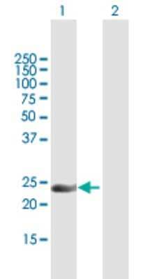 Western Blot: INF2 Antibody [H00064423-B02P]