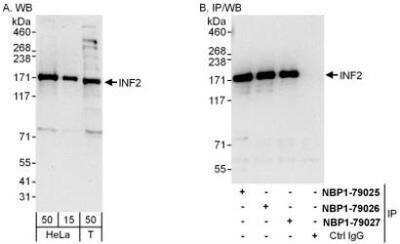 Western Blot: INF2 Antibody [NBP1-79025]