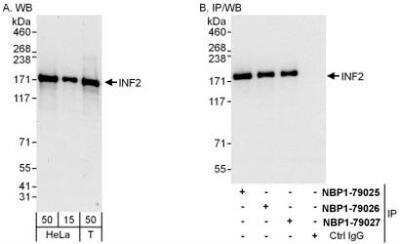 Western Blot: INF2 Antibody [NBP1-79026]