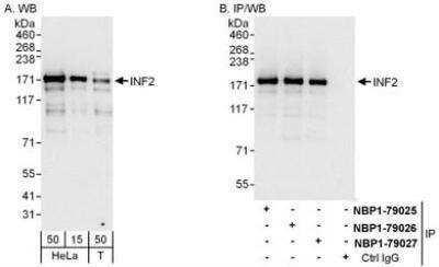 Western Blot: INF2 Antibody [NBP1-79027]