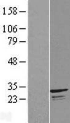 Western Blot: INF2 Overexpression Lysate [NBL1-08180]