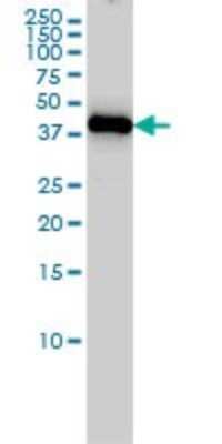 Western Blot: ING1 Antibody (2F9) [H00003621-M05]