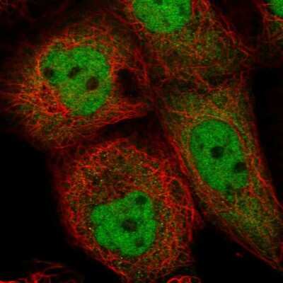 Immunocytochemistry/ Immunofluorescence: ING1 Antibody [NBP2-57223]