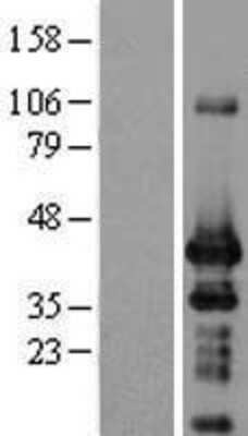 Western Blot: ING1 Overexpression Lysate [NBP2-04448]